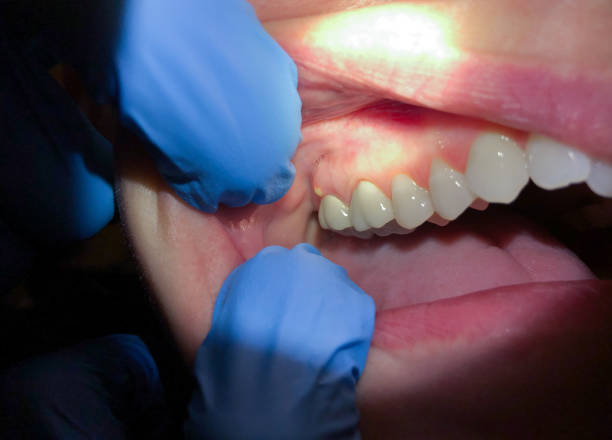 Best Walk-In Emergency Dentist in Shippensburg University, PA