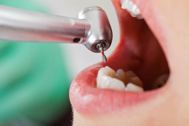 Best Walk-In Emergency Dentist in Shippensburg University, PA